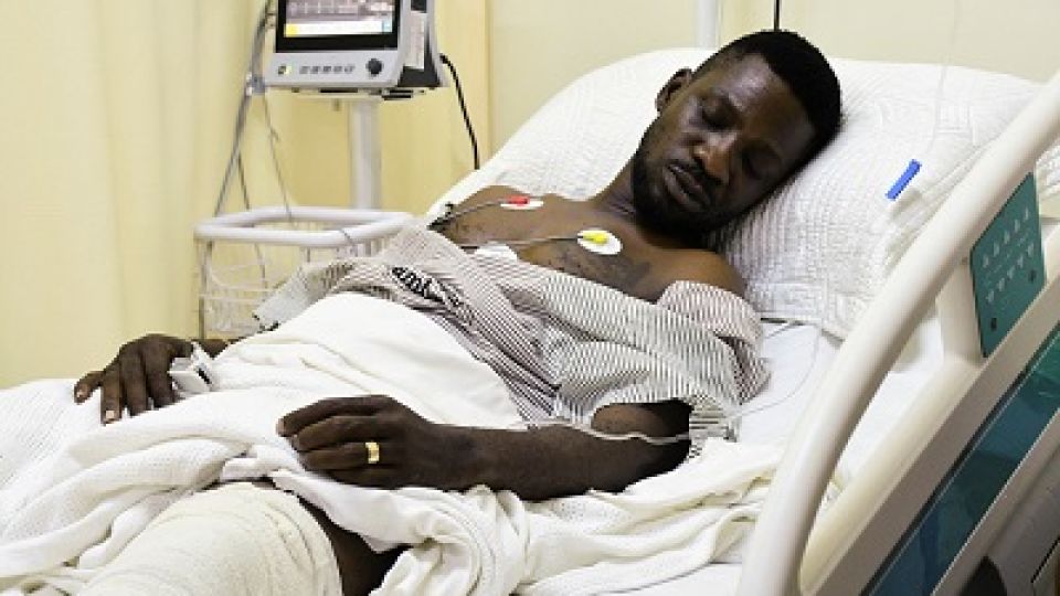 Bobi Wine Discharged After Leg Surgery Following Police Confrontation in Uganda