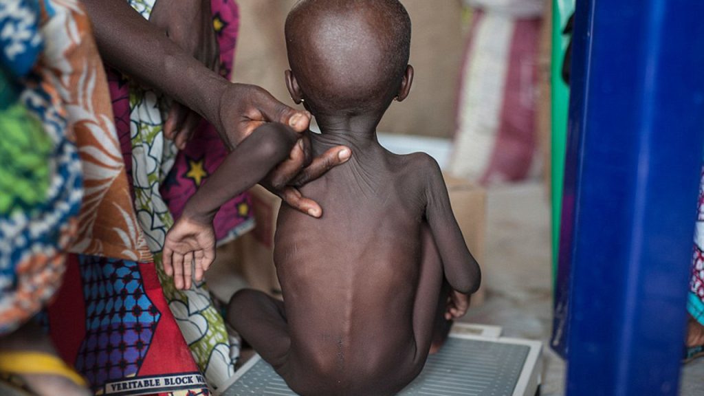 Red Cross Warns of Alarming Rise in Child Malnutrition in Northeast Nigeria