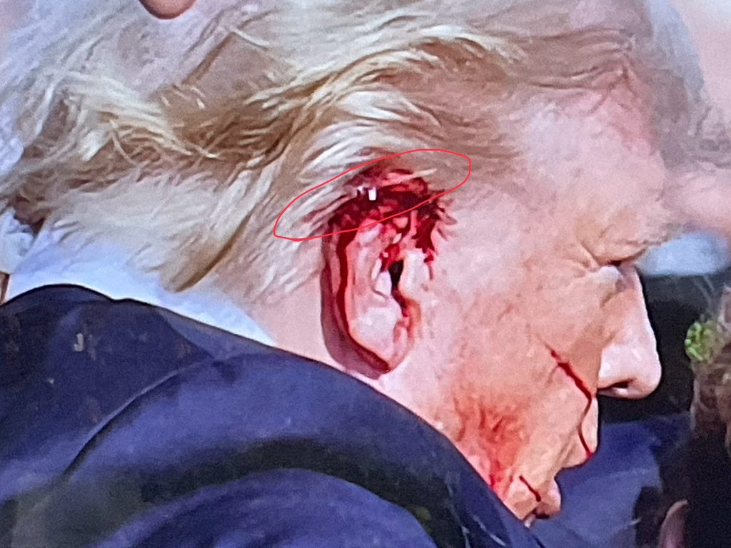 Trump Shot at (News Central TV)