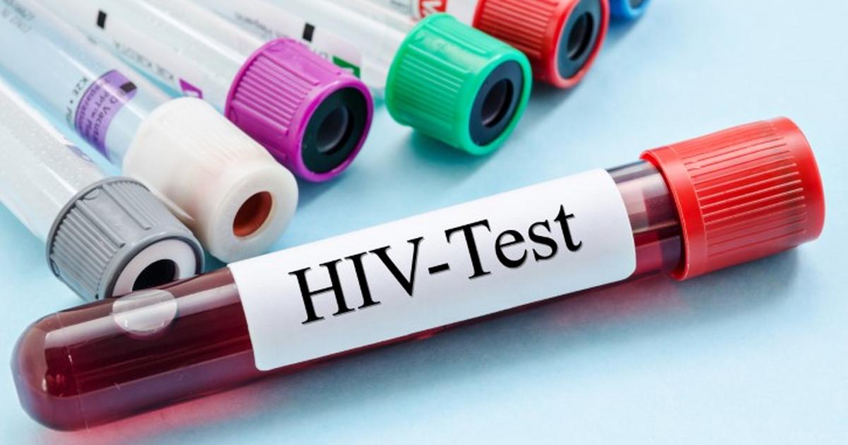 75,000 New HIV Infections, 45,000 Deaths Recorded in 2023— NACA