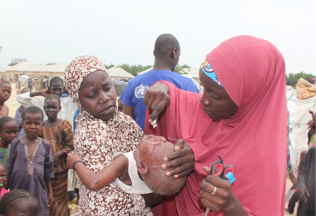 Adamawa Receives 200,000 Cholera Vaccines from UNICEF as Outbreak Spreads