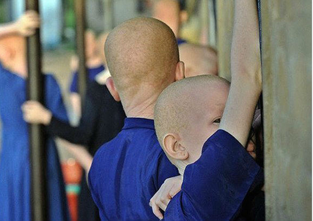 Albinos in Osun Advocate for Equal Rights and Opportunities