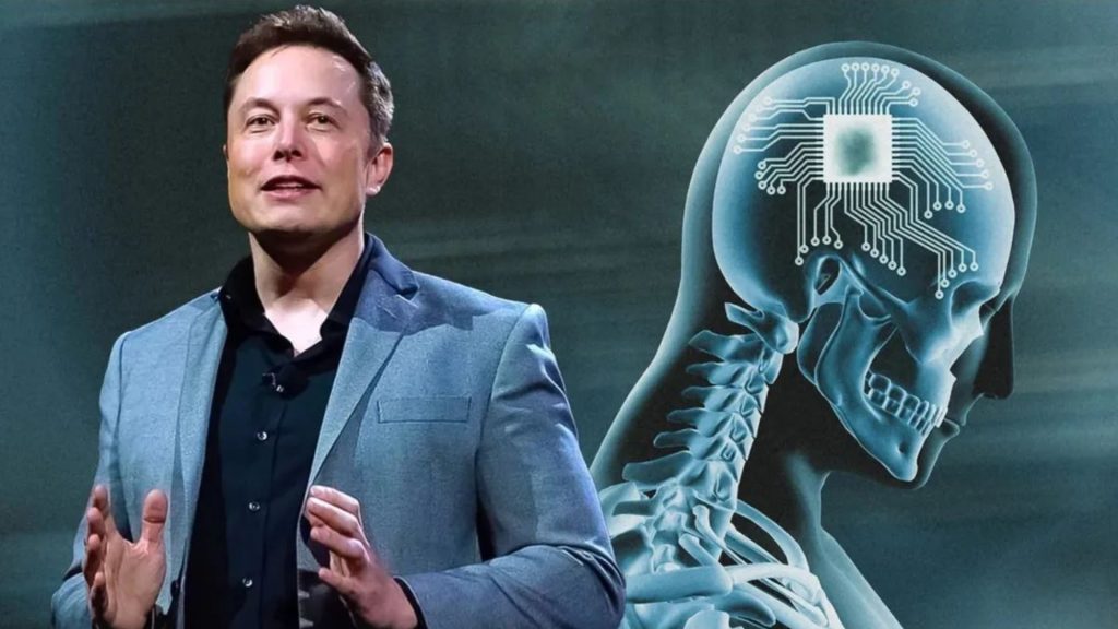 Elon-Musks-Neuralink (News Central TV)