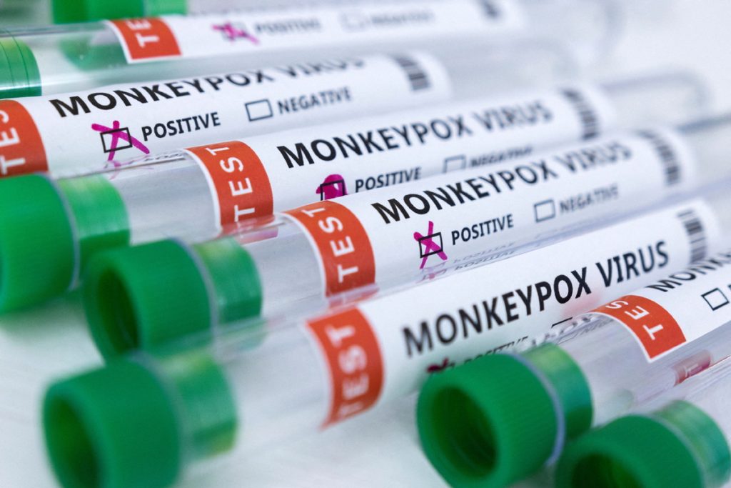 Kenya Reports First Mpox Case Amid Regional Health Concerns