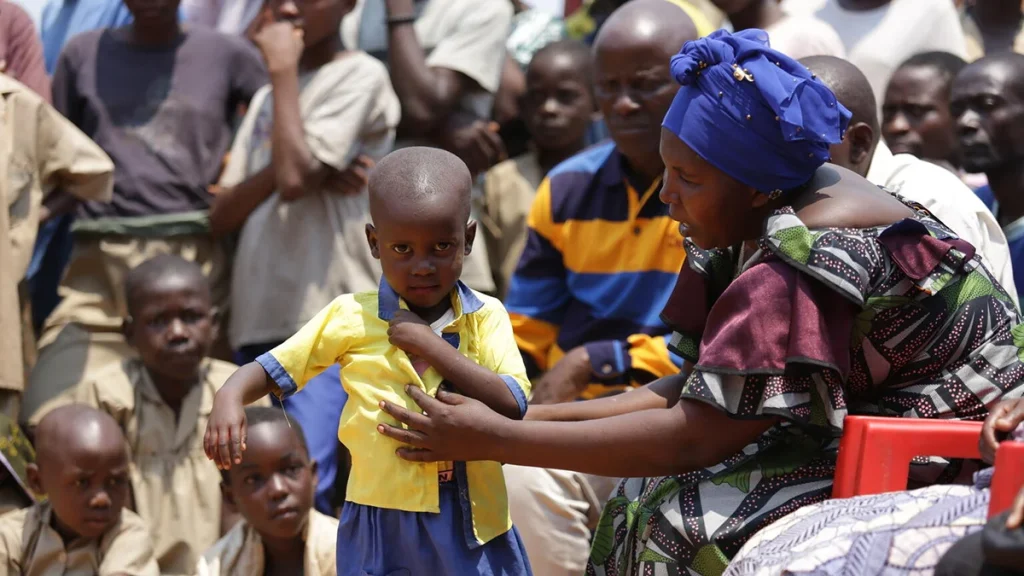 One-Third of Burundi Mpox Cases Are in Children Under Five UN Report