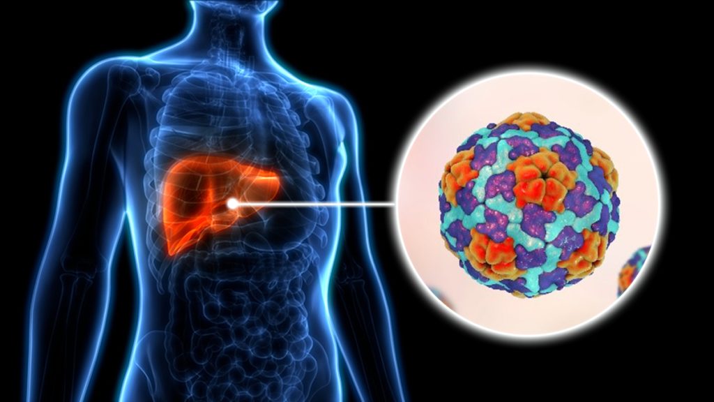 Over 15,000 Ghanaians Died of Hepatitis in 2022