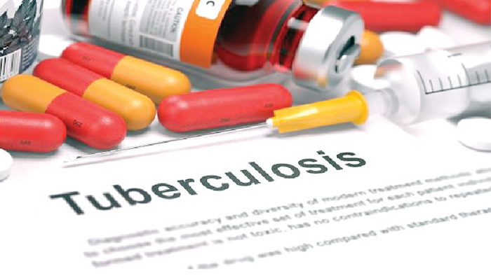 Over 2.5 Million Africans Contracted Tuberculosis in 2022 - WHO